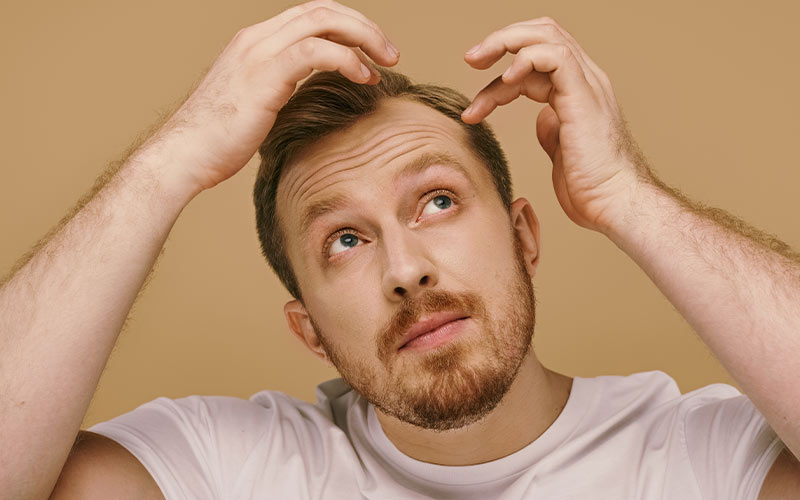 ERKEK TİPİ SAÇ DÖKÜLMESİ