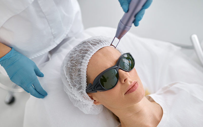 LAZERLE TÜY SARARTMA