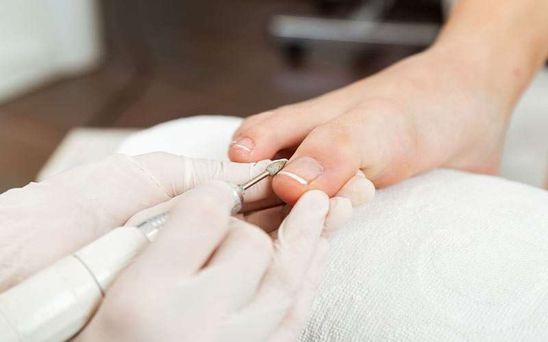 TIRNAK BATMASI TEDAVİSİ