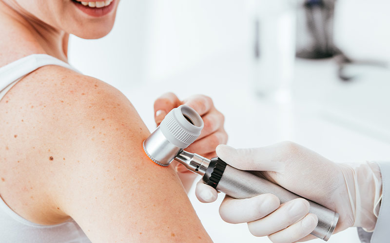 DERMATOLOJİK MUAYENE